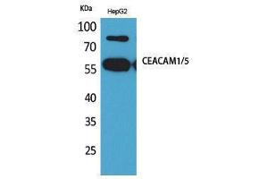 Western Blotting (WB) image for anti-Carcinoembryonic Antigen-Related Cell Adhesion Molecule 1/5 (CEACAM1/5) (N-Term) antibody (ABIN3178236) (CEACAM1/5 Antikörper  (N-Term))
