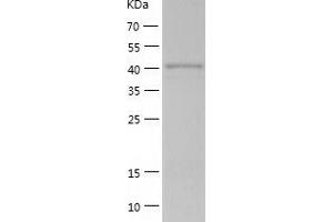 Western Blotting (WB) image for Proline-serine-threonine Phosphatase Interacting Protein 1 (PSTPIP1) (AA 1-416) protein (His tag) (ABIN7124597) (PSTPIP1 Protein (AA 1-416) (His tag))