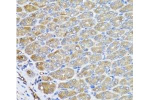 Immunohistochemistry of paraffin-embedded Mouse stomach using VPS37A Polyclonal Antibody at dilution of 1:100 (40x lens).