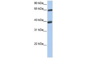 TKT antibody used at 1 ug/ml to detect target protein. (TKT Antikörper)