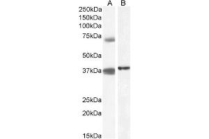 ABIN571104 (1µg/ml) staining of Peripheral Blood Mononucleocyte (A) and (0. (TRIM29 Antikörper  (Internal Region))