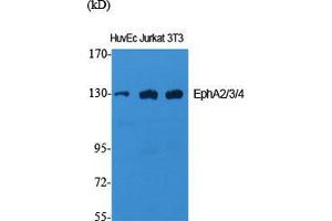 Western Blot (WB) analysis of specific cells using EphA2/3/4 Polyclonal Antibody. (EPHA2/3/4 Antikörper  (Lys14))
