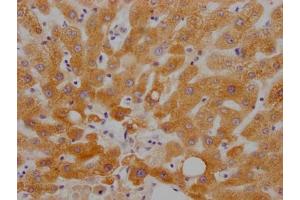 IHC image of ABIN7127790 diluted at 1:100 and staining in paraffin-embedded human liver tissue performed on a Leica BondTM system. (Rekombinanter RBP4 Antikörper)