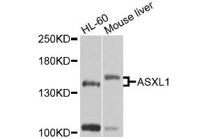 Western blot analysis of extracts of various cell lines, using ASXL1 antibody (ABIN6003622) at 1/1000 dilution. (ASXL1 Antikörper)