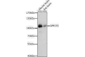 Western blot analysis of extracts of various cell lines, using GPR155 antibody (ABIN7267298) at 1:1000 dilution. (GPR155 Antikörper  (AA 721-870))