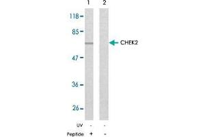 Western blot analysis of the extracts from Jurkat cells using CHEK2 polyclonal antibody  . (CHEK2 Antikörper)