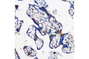 Immunohistochemistry of paraffin-embedded Human placenta using EY Rabbit pAb (ABIN6135167, ABIN6140386, ABIN6225031 and ABIN6225033) at dilution of 1:100 (40x lens). (EYA1 Antikörper  (AA 100-250))