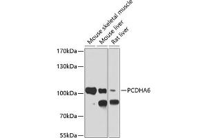 Western blot analysis of extracts of various cell lines, using PCDH antibody (ABIN6128584, ABIN6145301, ABIN6145302 and ABIN6220787) at 1:1000 dilution. (PCDHA6 Antikörper  (AA 1-230))