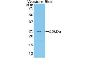Western Blotting (WB) image for anti-Sprouty Homolog 1, Antagonist of FGF Signaling (SPRY1) (AA 118-309) antibody (ABIN1860620) (SPRY1 Antikörper  (AA 118-309))