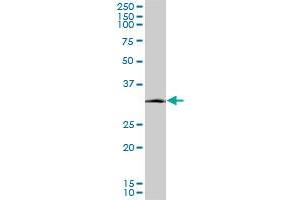 SIX3 monoclonal antibody (M08), clone 2B9. (SIX3 Antikörper  (AA 273-332))