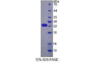 SDS-PAGE analysis of Mouse OPA3 Protein. (OPA3 Protein)