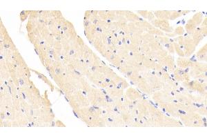 Detection of NOSTRIN in Mouse Cardiac Muscle Tissue using Polyclonal Antibody to Nitric Oxide Synthase Trafficker (NOSTRIN) (NOSTRIN Antikörper  (AA 6-245))