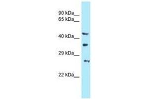 Image no. 1 for anti-U6 SnRNA Biogenesis 1 (USB1) (AA 150-199) antibody (ABIN6747953)
