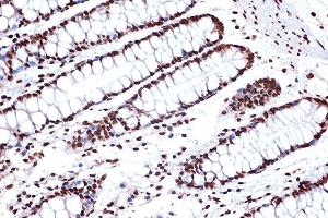 Immunohistochemistry of paraffin-embedded human colon using FUBP1 Rabbit mAb (ABIN7267128) at dilution of 1:100 (40x lens). (FUBP1 Antikörper)