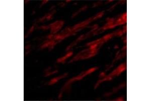 Immunofluorescence staining of human heart cells with CD274 polyclonal antibody  under 20 ug/mL working concentration.