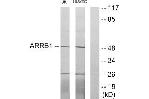 Western blot analysis of extracts from Jurkat cells and HUVEC cells, using ARRB1 antibody. (beta Arrestin 1 Antikörper)