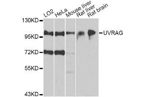 Western blot analysis of extracts of various cell lines, using UVRAG antibody. (UVRAG Antikörper  (AA 501-699))