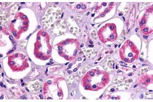 Anti-TAAR6 antibody  ABIN1049384 IHC staining of human kidney, renal tubules. (TAAR6 Antikörper  (Cytoplasmic Domain))