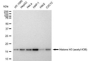 Western blotting analysis using Histone H3 (acetyl K36) antibody (ABIN7798951).
