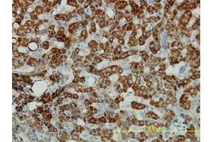 Image no. 1 for anti-Aldehyde Dehydrogenase 4 Family, Member A1 (ALDH4A1) (AA 1-564) antibody (ABIN599053) (ALDH4A1 Antikörper  (AA 1-564))