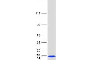 Western Blotting (WB) image for D-Dopachrome Tautomerase (DDT) (Transcript Variant 1) protein (Myc-DYKDDDDK Tag) (ABIN2712406)