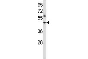 PDCD4 antibody western blot analysis in HL-60 lysate. (PDCD4 Antikörper  (AA 121-149))
