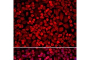 Immunofluorescence analysis of U2OS cells using NCOA1 Polyclonal Antibody (NCOA1 Antikörper)