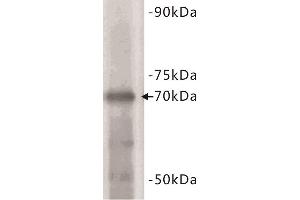 Western Blotting (WB) image for anti-Estrogen Receptor 1 (ESR1) (C-Term) antibody (ABIN1854892) (Estrogen Receptor alpha Antikörper  (C-Term))