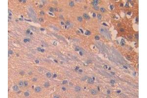 IHC-P analysis of Mouse Cerebrum Tissue, with DAB staining. (IL13 Receptor alpha 1 Antikörper  (AA 28-171))