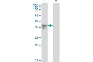Western Blot analysis of SERPINB3 expression in transfected 293T cell line by SERPINB3 monoclonal antibody (M01), clone 2F5. (SERPINB3 Antikörper  (AA 276-390))