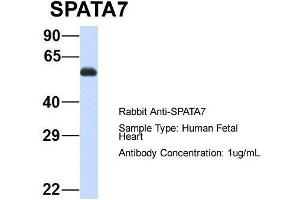 Host: Rabbit  Target Name: SPATA7  Sample Tissue: Human Fetal Heart  Antibody Dilution: 1. (SPATA7 Antikörper  (Middle Region))