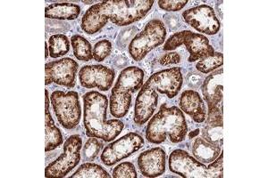 Immunohistochemical staining of human kidney with DNAJC16 polyclonal antibody  shows strong cytoplasmic positivity in cells in tubules at 1:50-1:200 dilution. (DNAJC16 Antikörper)