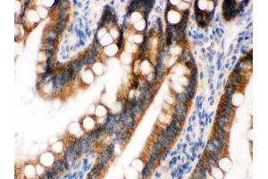 Immunohistochemistry (Paraffin-embedded Sections) (IHC (p)) image for anti-UPF1 Regulator of Nonsense Transcripts Homolog (UPF1) (AA 578-614), (Middle Region) antibody (ABIN3043955)