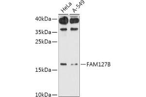 Western blot analysis of extracts of various cell lines, using FB antibody (ABIN7267107) at 1:1000 dilution. (FAM127B Antikörper  (AA 1-113))