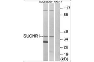 Western blot analysis of extracts from HuvEc/MCF-7 cells, using SUCNR1 Antibody. (SUCNR1 Antikörper)