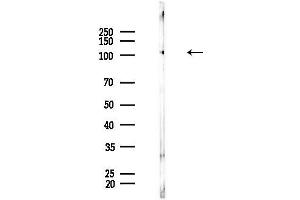 anti-Ubiquitin Specific Peptidase 15 (USP15) (N-Term) antibody