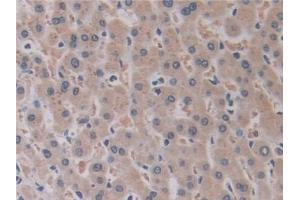 Immunohistochemistry (IHC) image for anti-ADAM Metallopeptidase Domain 17 (ADAM17) (AA 226-473) antibody (ABIN7426310)