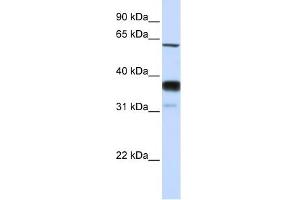 SMPD3 antibody used at 1 ug/ml to detect target protein. (SMPD3 Antikörper)