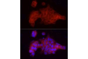 Immunofluorescence analysis of MCF7 cells using VEGFR3/FLT4 Rabbit pAb (ABIN6130779, ABIN6140698, ABIN6140701 and ABIN6217251) at dilution of 1:100 (40x lens). (FLT4 Antikörper  (AA 1174-1363))
