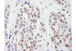 anti-Structural Maintenance of Chromosomes 1A (SMC1A) (AA 1183-1233) antibody