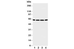Western blot testing of P2X6 antibody and Lane 1:  U87 (P2RX6 Antikörper  (C-Term))