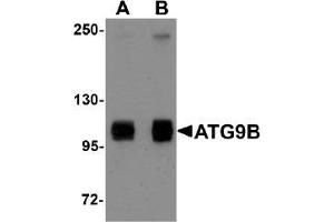 AP20065PU-N ATG9B antibody staining of HeLa Cell Lysate by Western Blotting at (A) 1 and (B) 2 µg/ml