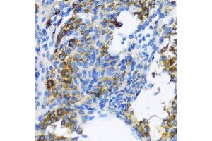 Immunohistochemistry of paraffin-embedded Rat ovary using PTCH1 antibody (ABIN1682368, ABIN1682367, ABIN3015342, ABIN3015343 and ABIN6213997) at dilution of 1:100 (40x lens). (Patched 1 Antikörper  (AA 1214-1312))