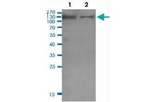 Western Blot (Cell lysate) analysis of (1) KB cell lysate and (2) PC-3 cell lysate. (INPP5D Antikörper  (pTyr1021))