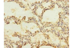Immunohistochemistry of paraffin-embedded human lung tissue using ABIN7175581 at dilution of 1:100 (CACNA2D2 Antikörper  (AA 20-200))
