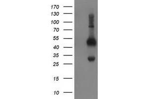 HEK293T cells were transfected with the pCMV6-ENTRY control (Left lane) or pCMV6-ENTRY BECN1 (Right lane) cDNA for 48 hrs and lysed. (Beclin 1 Antikörper)