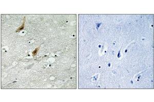 Immunohistochemistry analysis of paraffin-embedded human brain tissue using MSK2 (Phospho-Thr568) antibody. (MSK2 Antikörper  (pThr568))