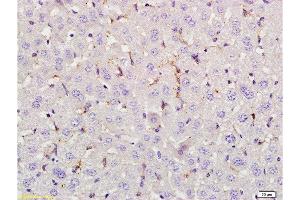 Immunohistochemistry (Paraffin-embedded Sections) (IHC (p)) image for anti-Lymphoid Enhancer-Binding Factor 1 (LEF1) (AA 331-399) antibody (ABIN735248)