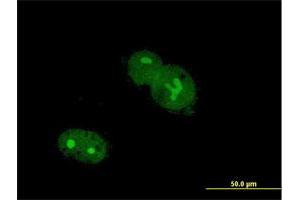 Immunofluorescence of purified MaxPab antibody to ZNF32 on Hs 181. (ZNF32 Antikörper  (AA 1-273))