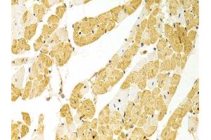 Immunohistochemistry of paraffin-embedded rat heart using PLCB1 antibody at dilution of 1:100 (x400 lens). (Phospholipase C beta 1 Antikörper)